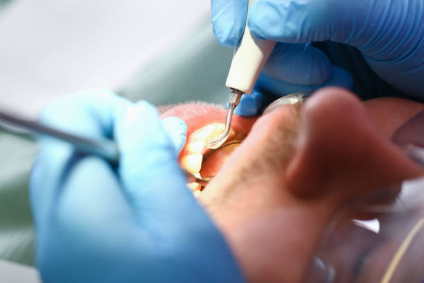 Best Dentist for Dental Trauma  in Priceville, AL