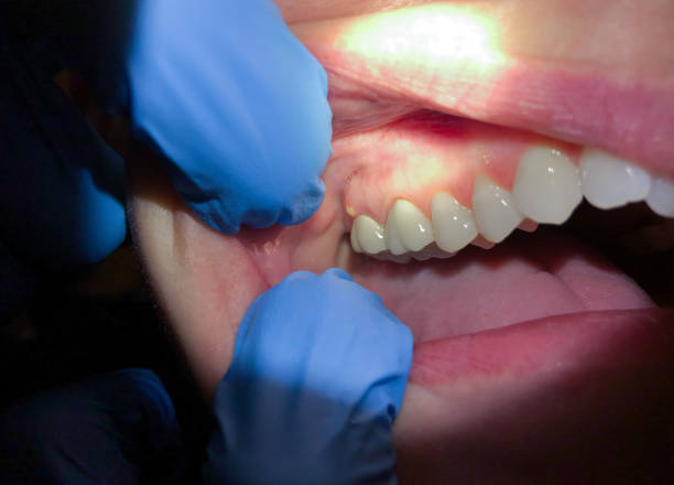 Best Broken Tooth Emergency  in Priceville, AL