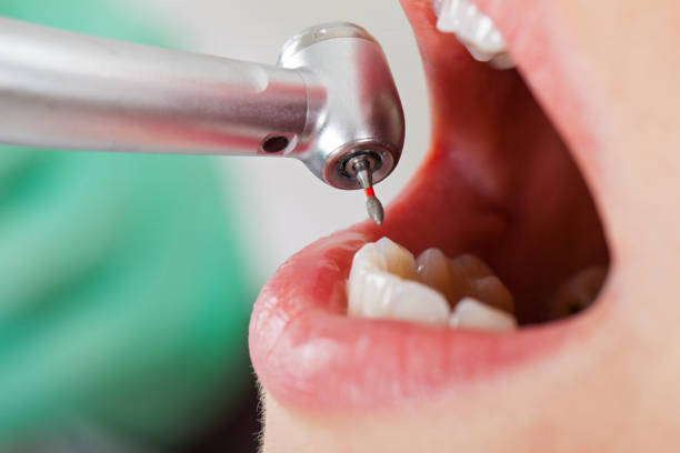 Best Dentist for Tooth Abscess  in Priceville, AL